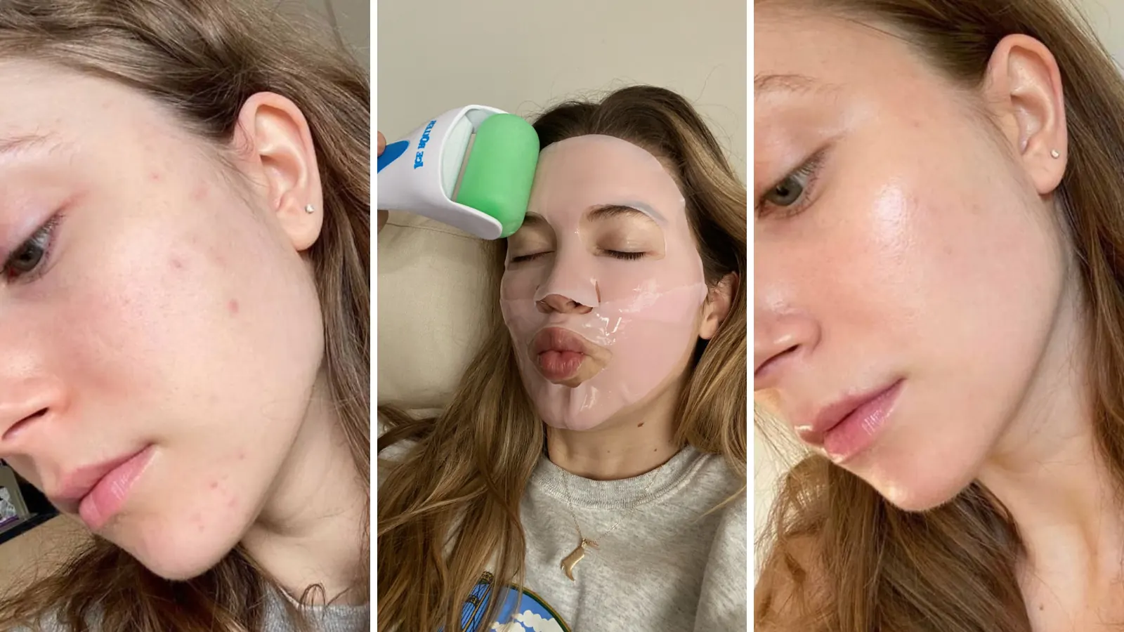 How to Reduce Open Pores Feature Image